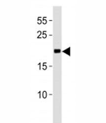 MGMT Antibody
