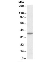 Western blot testing of mouse brain lysate with CADM1 antibody at 1ug/ml. Predicted molecular weight