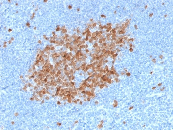 IHC testing of FFPE human tonsil tissue with TYMS antibody. HIER: boil tissue sections in pH 9 10mM 