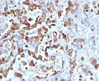 Cytokeratin 20 Antibody / CK20