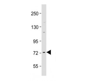 Raf1 Antibody / c-Raf