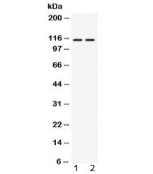 Western blot testing of 1) rat thymus and 2) human 22RV1 lysate with AGO4 antibody at 0.5ug/ml. Pred