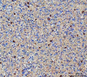 MGAT4B Antibody