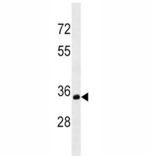 CD20 Antibody (MS4A1)