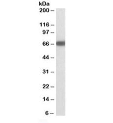 Western blot testing of mouse brain lysate with GAD67 antibody at 1ug/ml. Predicted molecular weight
