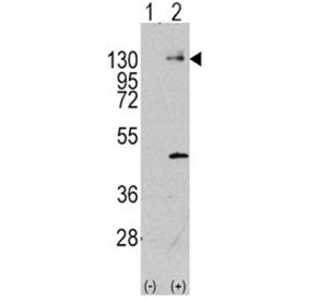 Platelet Derived Growth Factor Receptor alpha Antibody (PDGFRA)