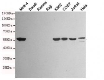 Western blot testing of Vimentin-positive cell lines (Molt-4, K562, COS7, Jurkat, HeLa) and Vimentin