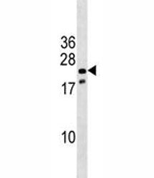 Nkx3.1 Antibody