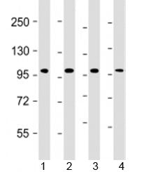 Western blot testing of human 1) HT-29, 2) K562, 3) MCF-7 and 4) Raji cell lysate with TPX2 antibody