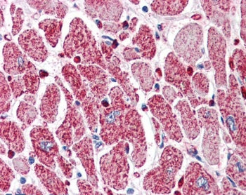PIK3C2A Antibody