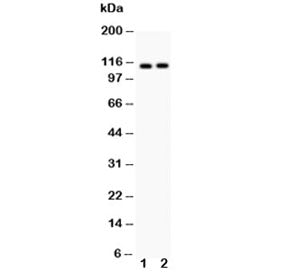 Western blot testing of ATP2A2 antibody and Lane 1: rat skeletal muscle; 2: mouse skeletal muscle; Expected molecular weight ~115 kDa.