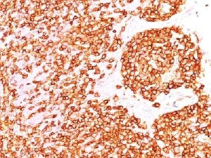 IHC test of FFPE human tonsil probed with CD45RB antibody