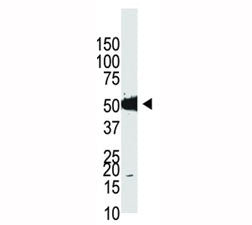 Dnmt2 Antibody