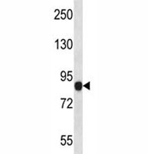 NLRP6 Antibody