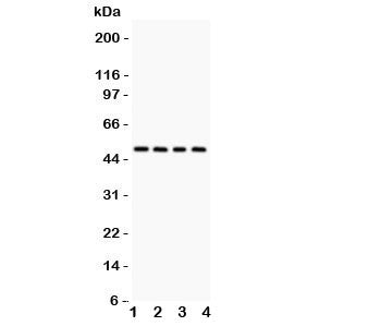 Western blot testing of Alpha 1 Antitrypsin antibody and Lane 1: rat testis; 2: mouse testis; 3: (r) liver; 4: (m) liver lysate. Expected molecular weight: ~47 kDa (unmodified), 52 kDa (glycosylated).