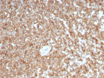 IHC staining of FFPE human spleen with GMCSF antibody (clone CSF2/3403). HIER: boil tissue sections 