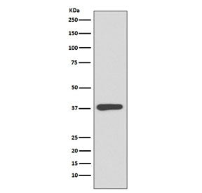 Western blot testing of E. coli lysate with Maltose Binding Protein antibody. Predicted molecular we