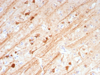 MAP2 Antibody / Microtubule-associated protein 2