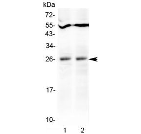 Western blot testing of mouse 1) spleen and 2) heart tissue lysate with Tnfsf14 antibody at 0.5ug/ml