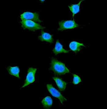 Galectin 1 Antibody