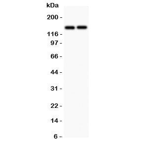 Western blot testing of CD45 antibody and Lane 1: Jurkat; 2: Raji lysate. Expected molecular weight: