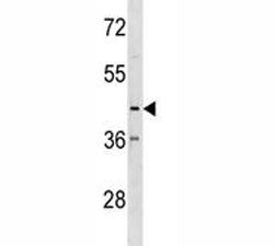 CX3CR1 Antibody