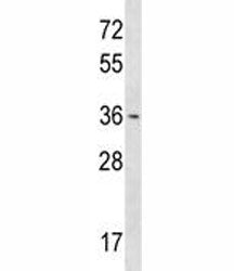 OTX1 Antibody