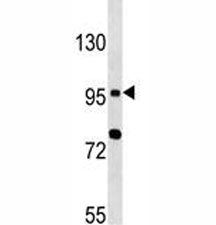 TLR6 Antibody