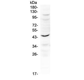 Western blot testing of mouse kidney tissue with Il12 p40 antibody at 0.5ug/ml. Predicted molecular 