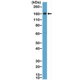 CD163 Antibody
