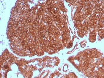 IHC staining of FFPE human parathyroid gland with RET Proto-oncogene antibody (clone RET/7690). HIER