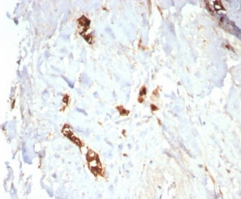 Mammaglobin A Antibody / SCGB2A2