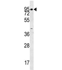 ABP1 Antibody / Amiloride binding protein 1