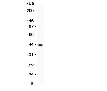 SERPINB2 Antibody