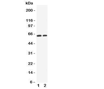 OCT1 Antibody (SLC22A1)