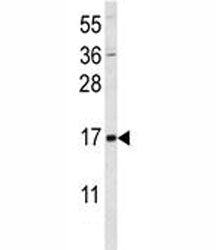 SUMO1 Antibody