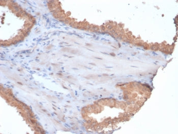 IHC staining of FFPE human prostate tissue with HSP90 alpha antibody (clone HSP90AA1/7247). HIER: bo