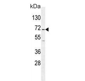 GAD65 Antibody / GAD2