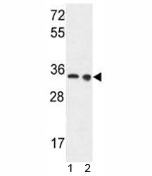 LDHA Antibody
