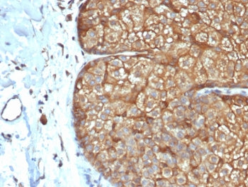 IHC staining of FFPE human sebaceous gland with recombinant Acidic Cytokeratin antibody (clone rKRTL