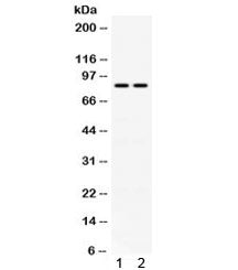 Phospholipase A2 Antibody / PLA2G4A / CPLA2