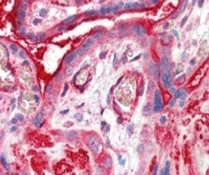 ADAP2 Antibody