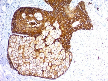 Pan Cytokeratin Antibody Cocktail (Acidic + Basic)