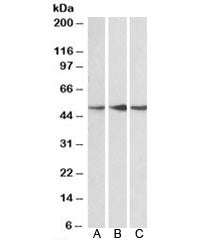 PPP2R5E Antibody