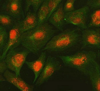 SMC2 Antibody / Structural maintenance of chromosomes protein 2