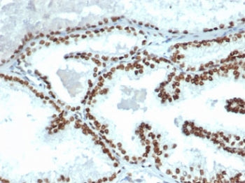 Androgen Receptor Antibody
