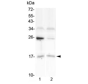 IL1F10 Antibody / IL-38