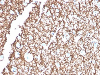 IHC staining of FFPE human brain with MBP antibody. HIER: boil tissue sections in pH 9 10mM Tris wit