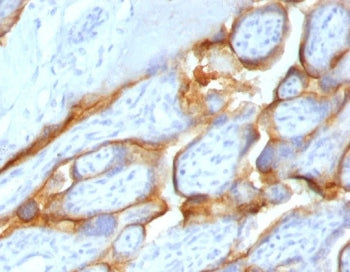 IHC testing of FFPE human placenta with HCG-beta antibody (clone CGB63-2R). Required HIER: boil tiss