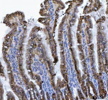 IHC staining of FFPE mouse colon tissue with CDH17 antibody. HIER: boil tissue sections in pH8 EDTA 